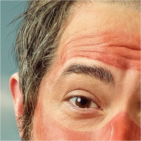 Big Reveal Sun Scorch Close Up Eye
